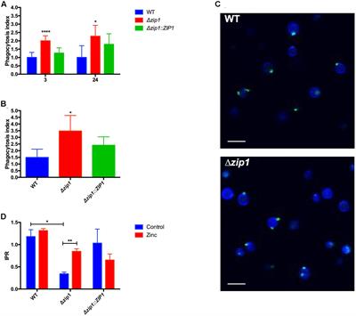 Modulation of Zinc Homeostasis in <mark class="highlighted">Acanthamoeba castellanii</mark> as a Possible Antifungal Strategy against Cryptococcus gattii